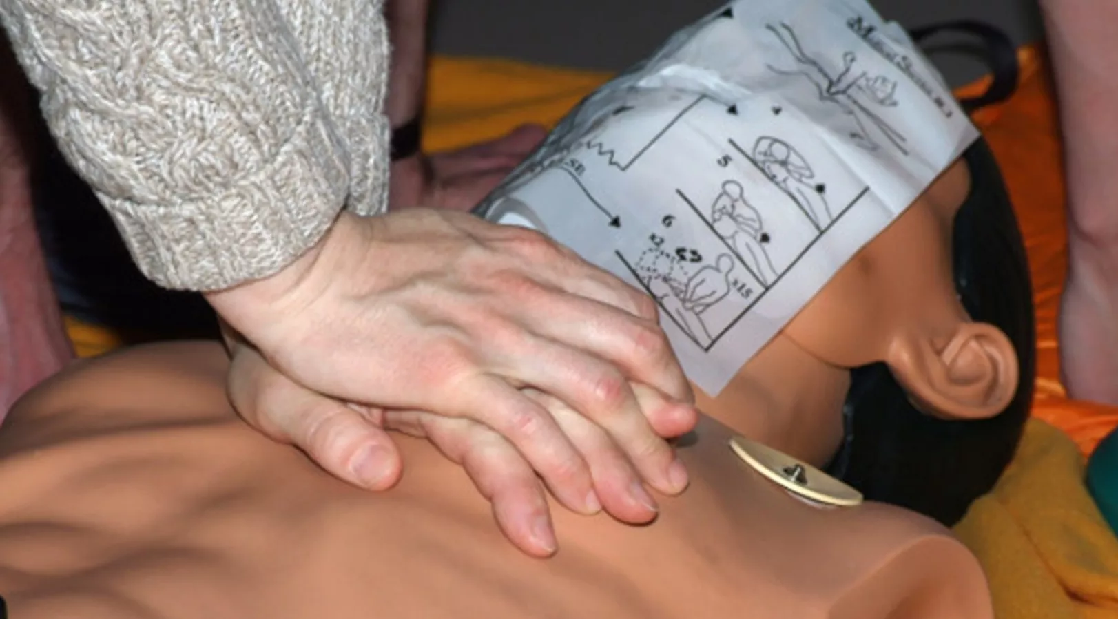 Cardiopulmonary resuscitation