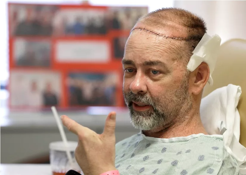Skull Transplant