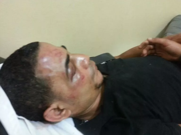 ladron herido