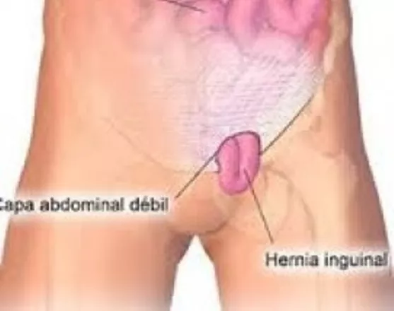 aS454VXCsDherniad