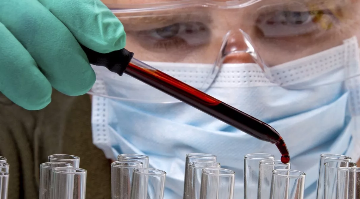 Blood Sample