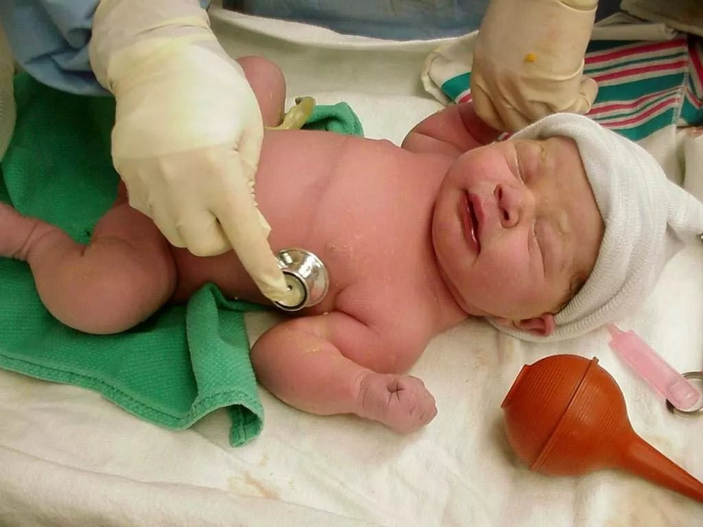 plan-accion-bajar-mortalidad-neonatal-L-0PECcn