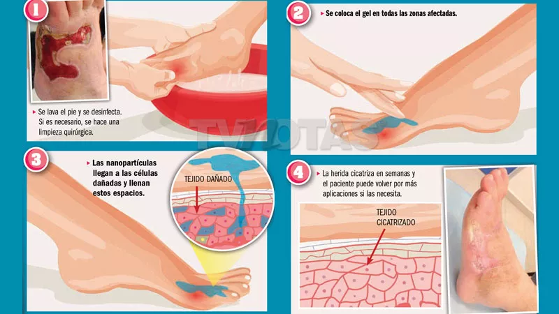 tvn-curapiediabetico_w2