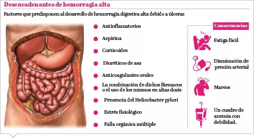 info-hemorragia-digestiva