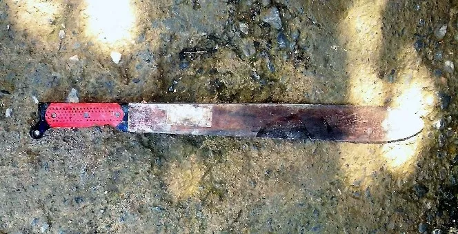 hieren-joven-de-un-machetazo-durante-rina-en-sector-de-puerto-plata