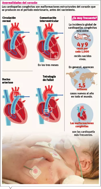 info-cardiopatias-congenitas