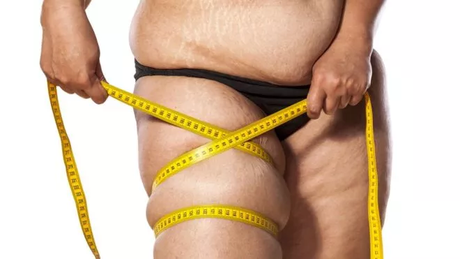 _107567836_legfat