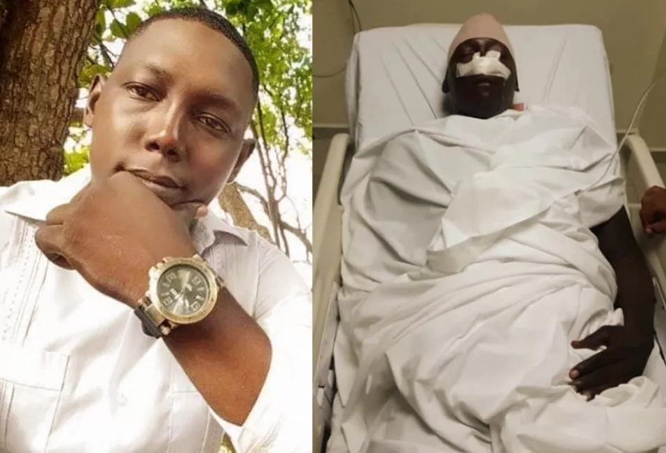 se-debate-entre-la-vida-y-la-muerte-cabo-policial-herido-con-un-block-en-la-cabeza-durante-incidente-en-sector-de-puerto-plata