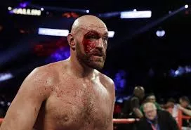 tyson-fury