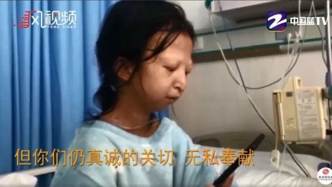 China-desnutrición-salud-pobreza