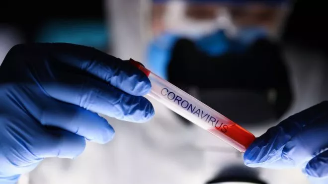 CORONAVIRUS-PRUEBA