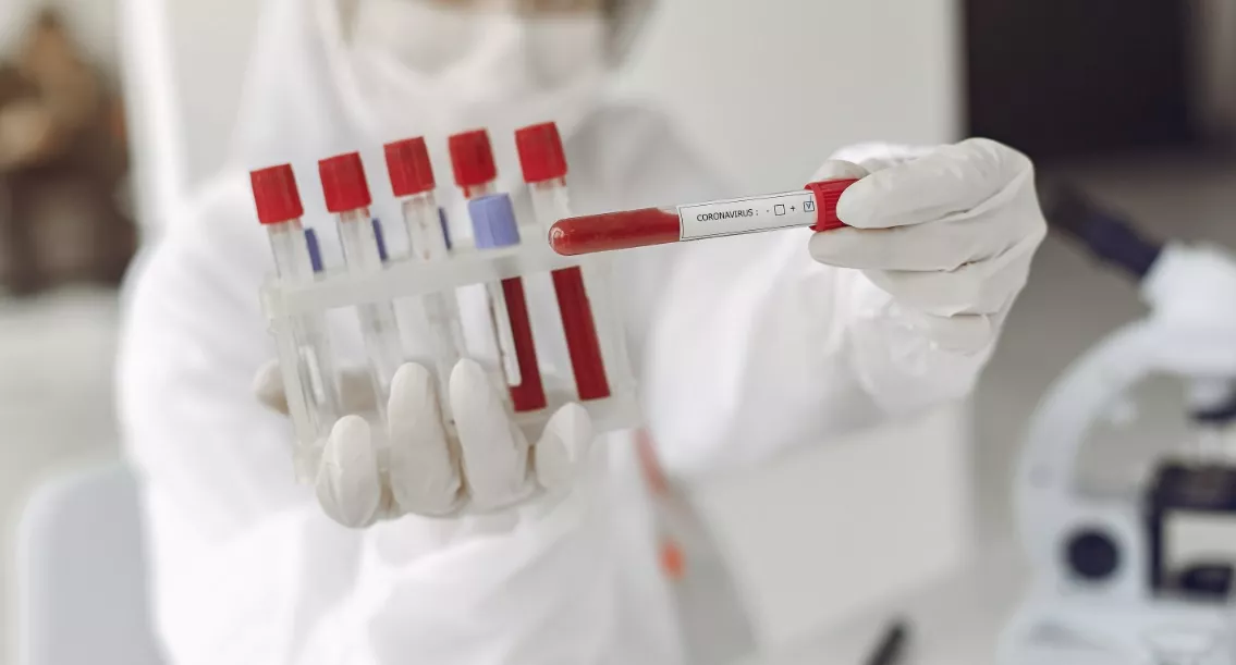 PruebaCoronavirus