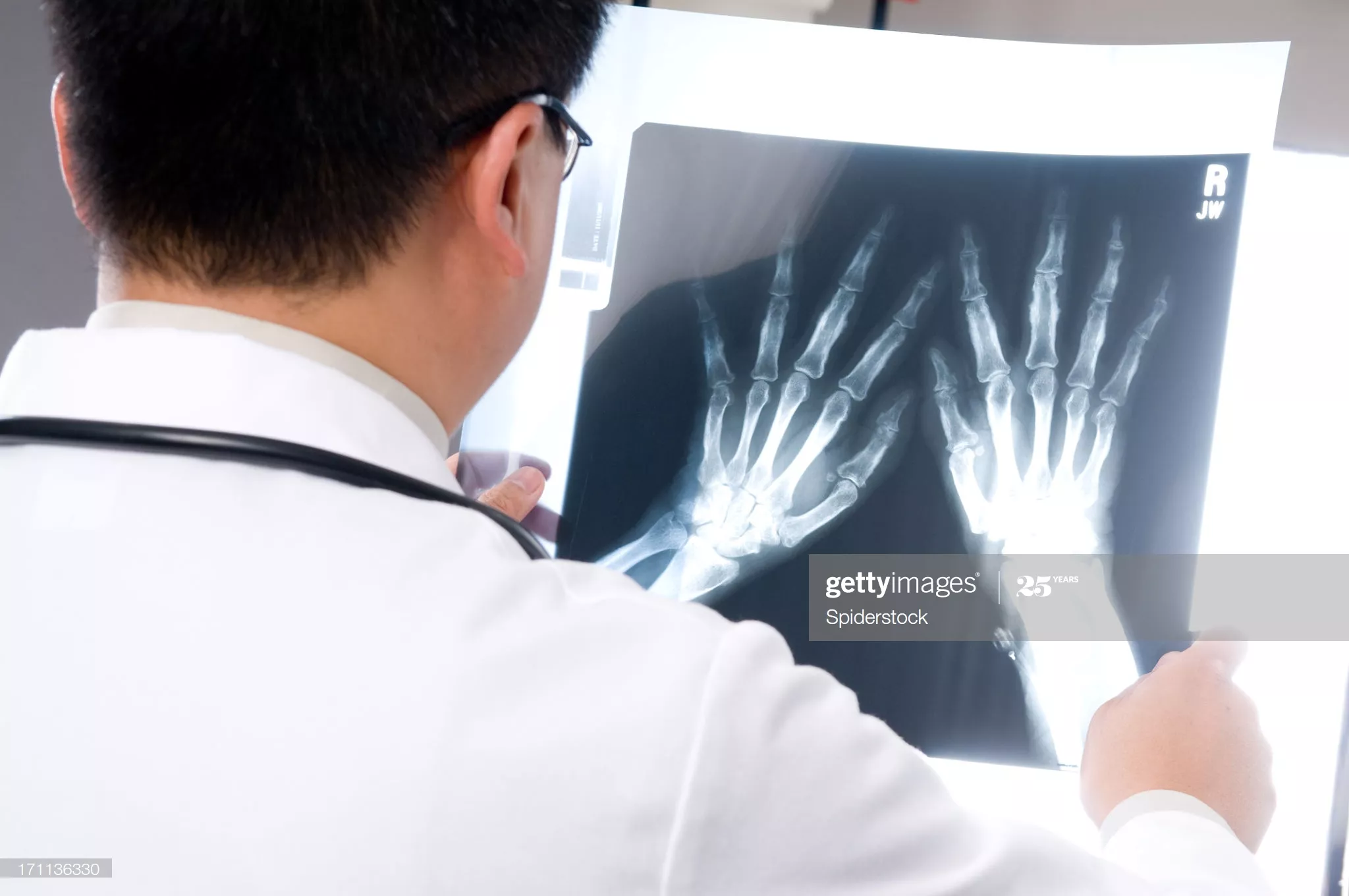 Asian Doctor in white lab coat looking at hand x-ray.