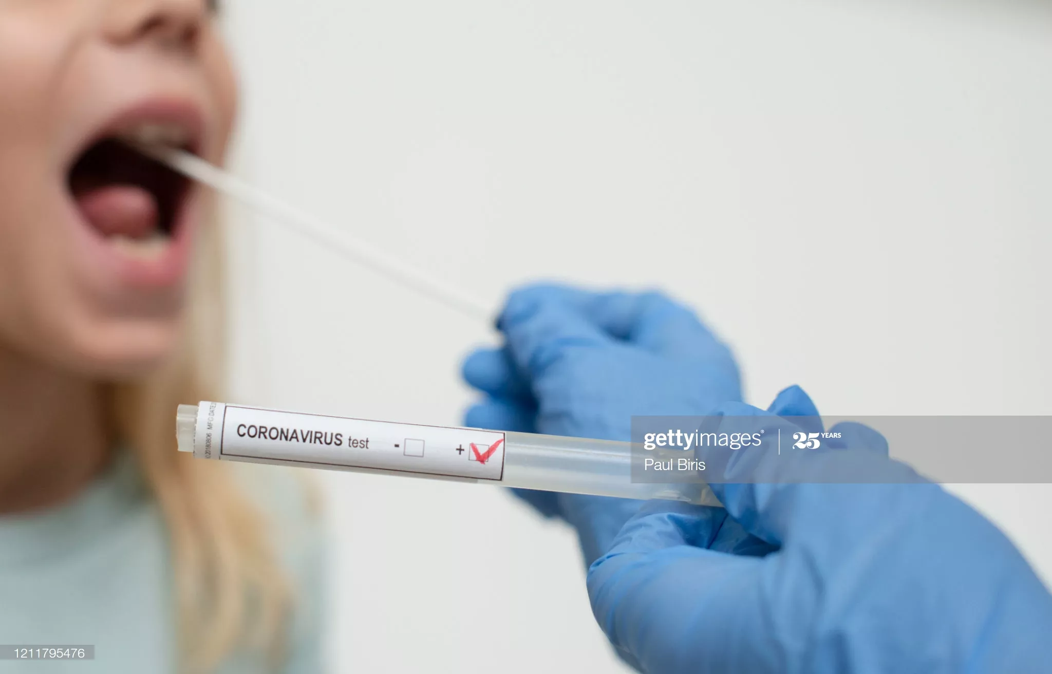 coronavirus-pruebas-consultas