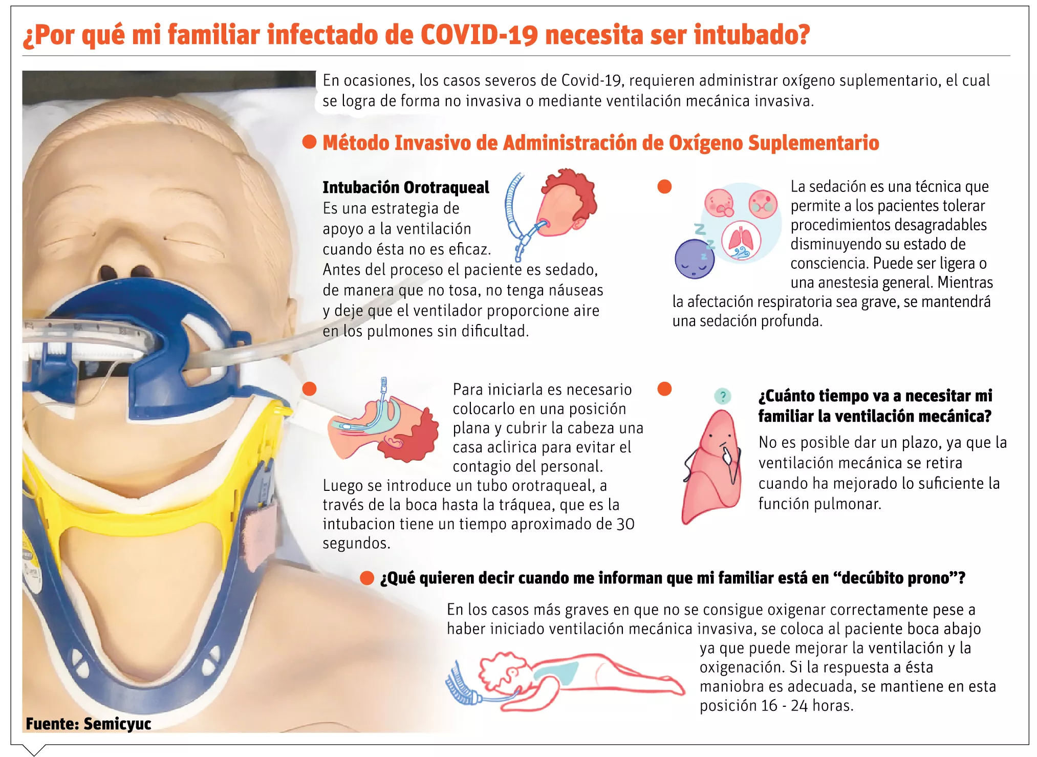 info-INTUBACION