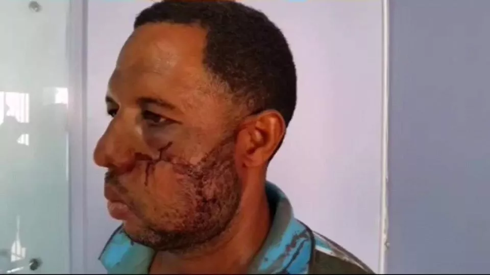 HOMBRE DENUNCIA FUE GOLPEADO POR AGENTE POLICIAL EN CUARTEL DE PUERTO PLATA TRAS SER DETENIDO EN TOQUE DE QUEDA