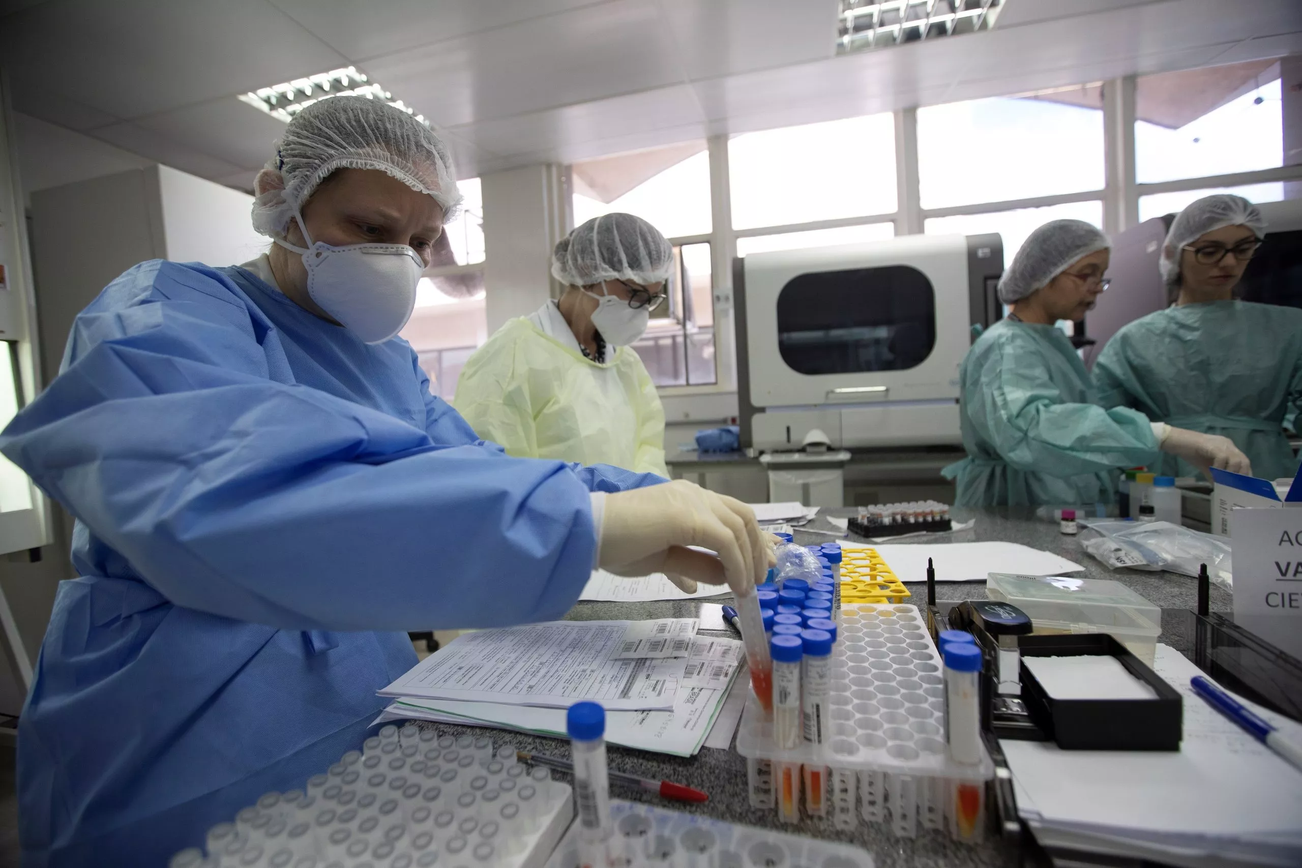 Los casos de coronavirus a nivel mundial llegan a 34,8 millones