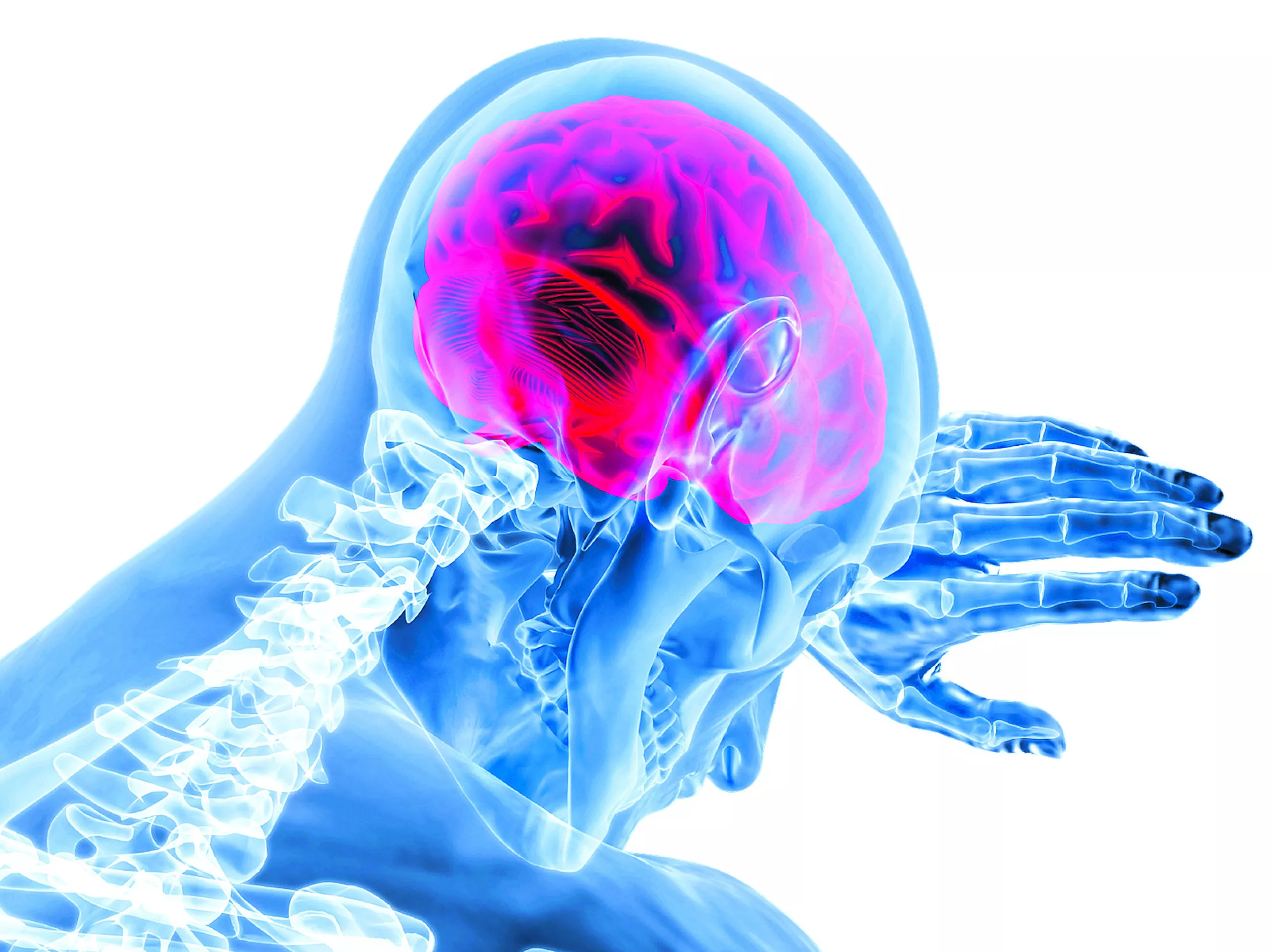 Enfermedad cerebrovascular