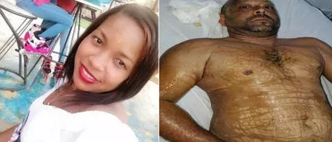 Pareja rociada con ácido del diablo.