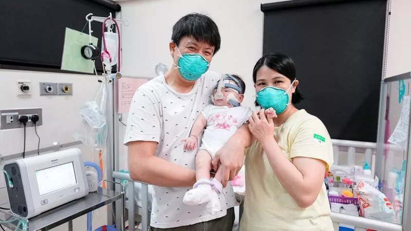 Kwek Yu Xuan junto a sus padres. (Foto: National University Hospital)