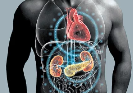 infartos