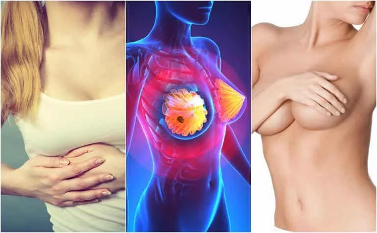 Los-9-síntomas-de-cáncer-de-mama-que-toda-mujer-debe-conocer-768×475