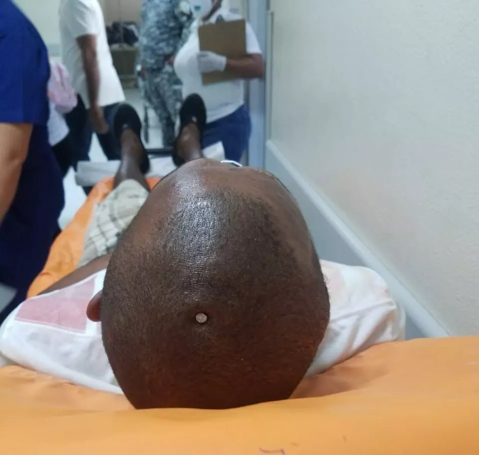 ¡INCREÍBLE PERO CIERTO! HOMBRE ENDROGADO SE MARTILLÓ CLAVO EN LA CABEZA Y SE PERFORA OREJA CON UNA ESPINA EN PUERTO PLATA