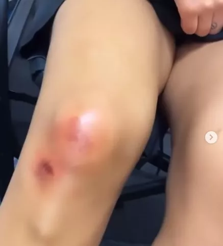Karol