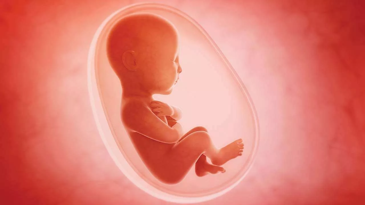 Aborto