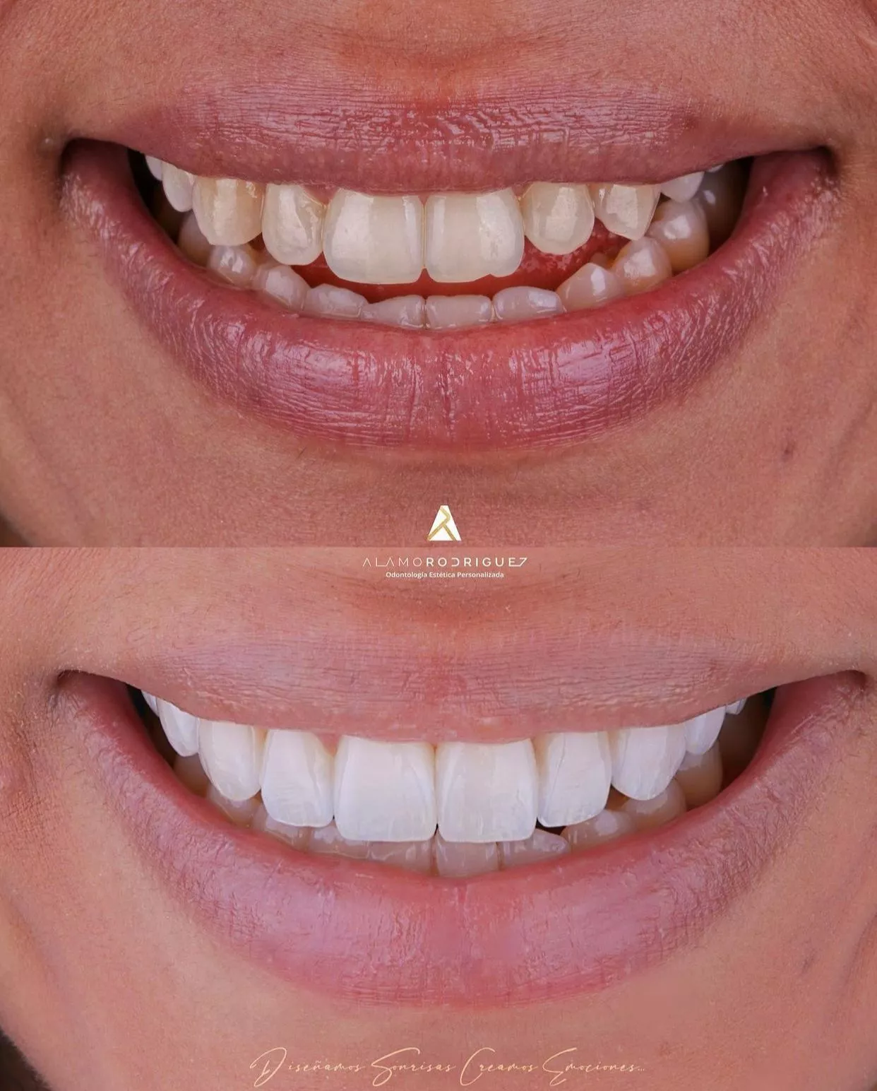 Su técnica Smile Mimetic y su crecimiento lo vuelven referencia en el diseño de sonrisa.