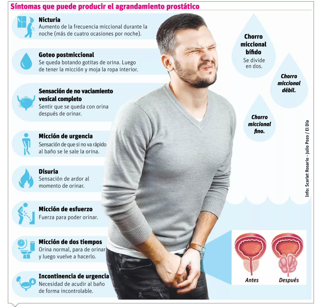info-PROSTATICO
