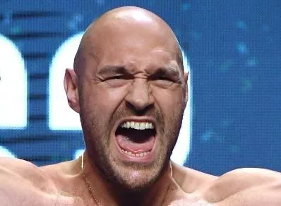 Fury irá contra Dillan Whyte.