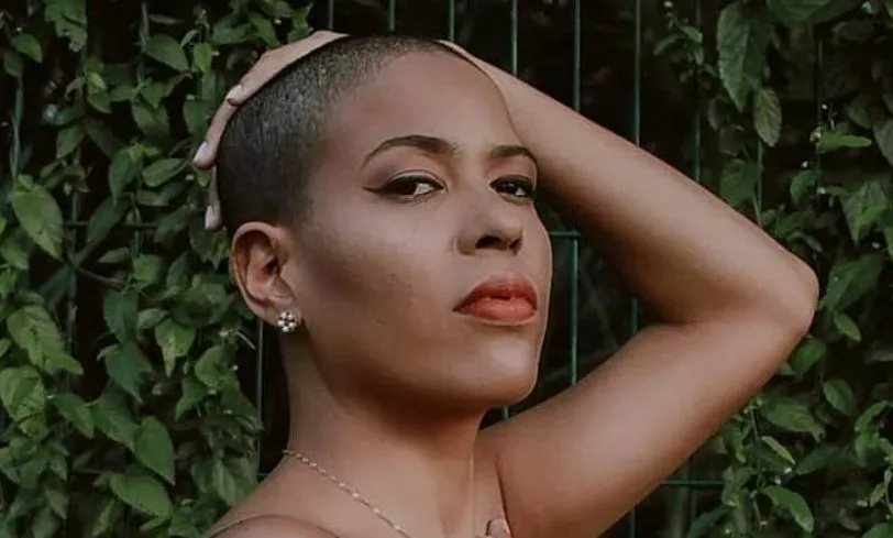 alopecia