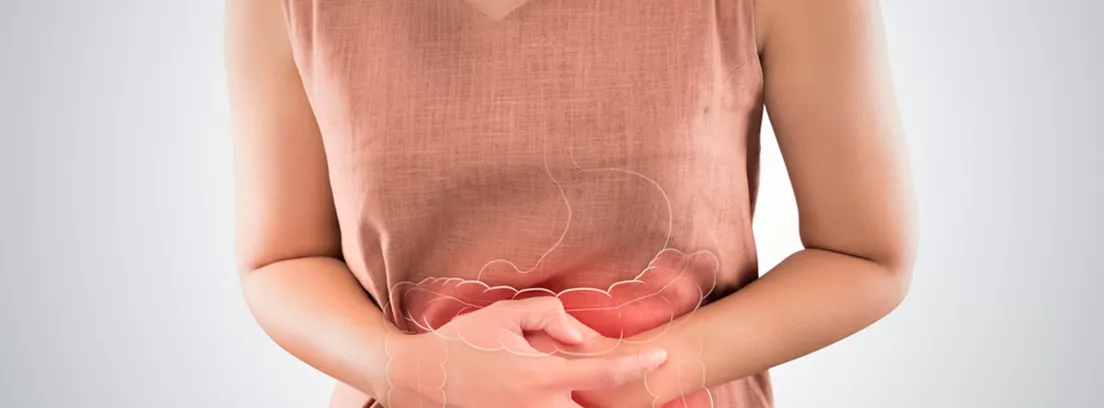 Colitis ulcerosa