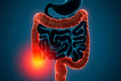 colitis_ulcerosa