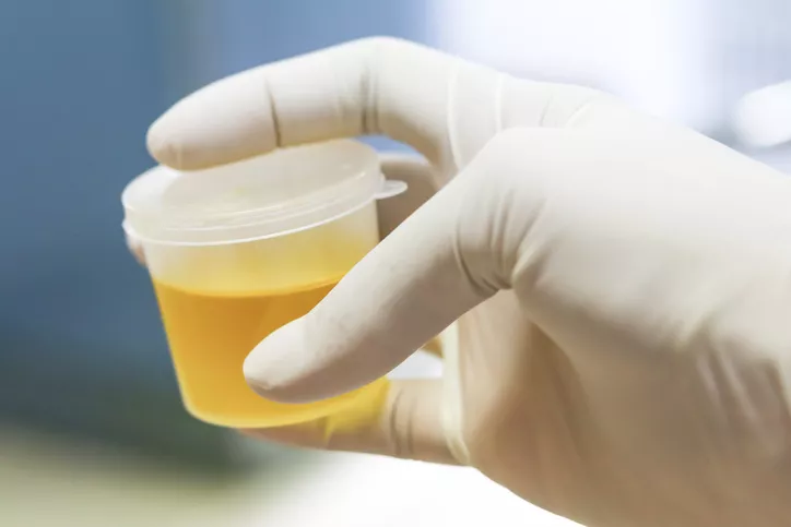 urine sample