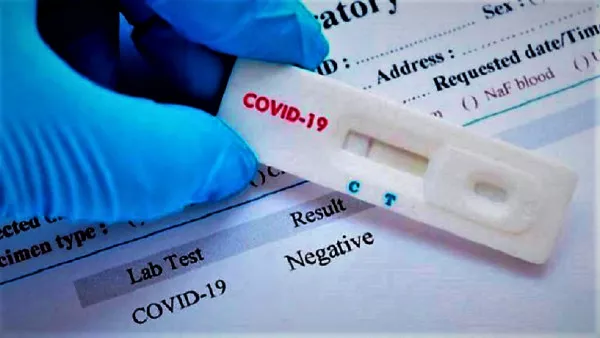 covid-19