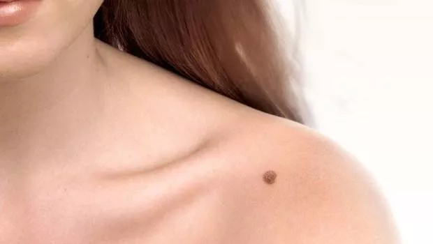 Mujer con lunares