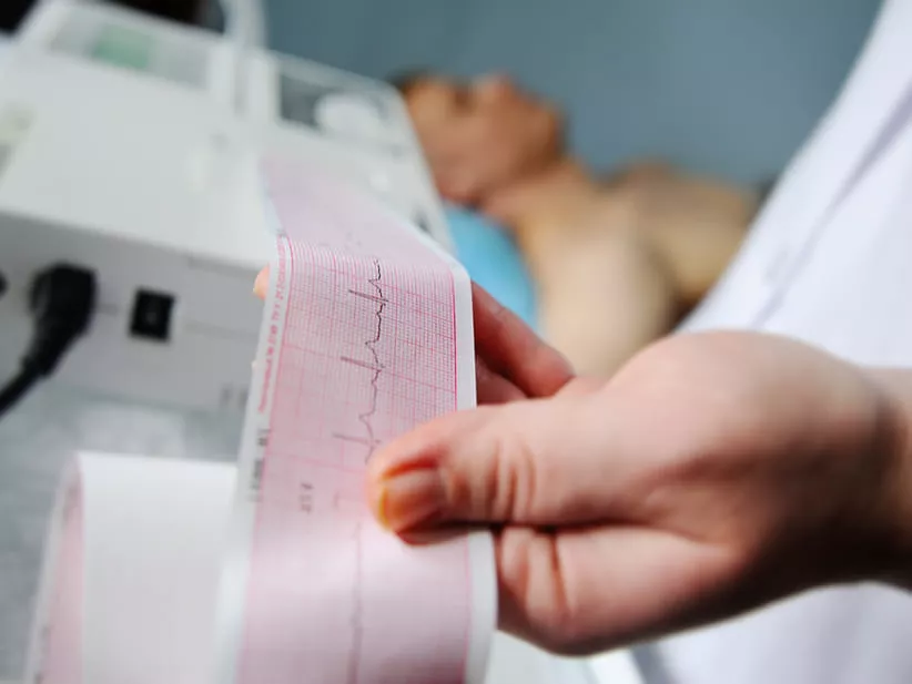 taquicardia-ventricular-que-es-y-como-tratarla