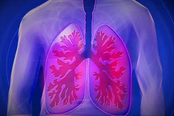 Tratamiento fibrosis quística