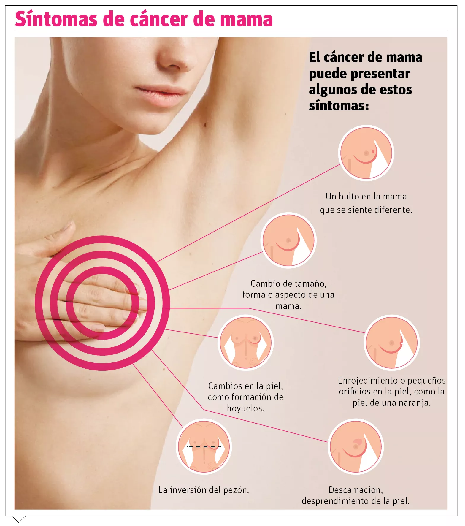 info-SINTOMAS CANCER MAMA