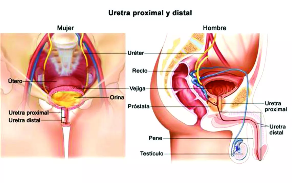 Los gérmenes causante de uretritis pueden generar infertilidad, procesos inflamatorios en testículos, próstata y  vejiga.