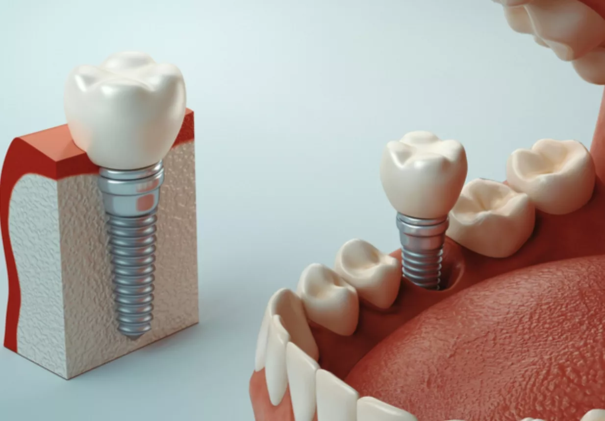 Dental care
