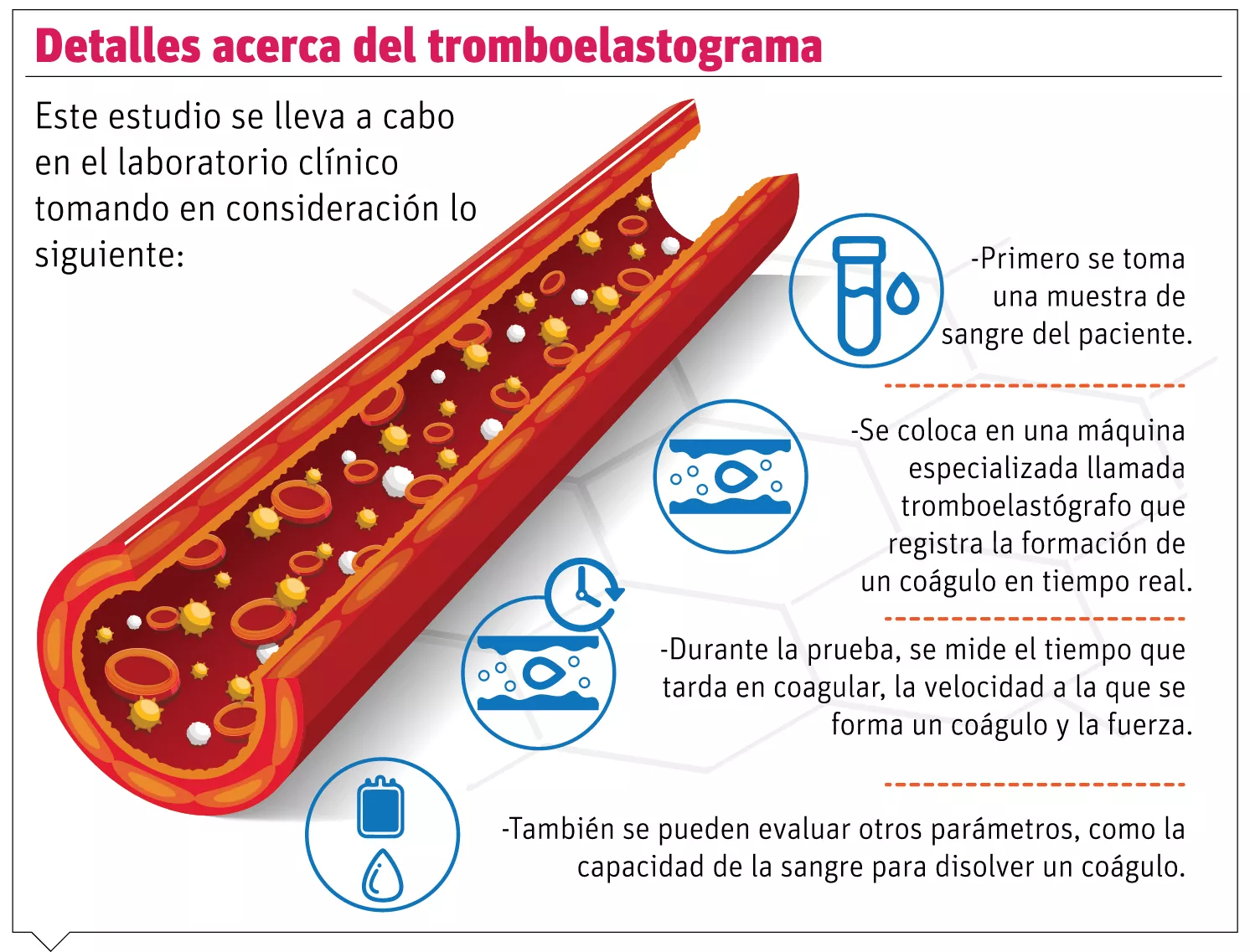 info-TROMBOELASTOGRAMA