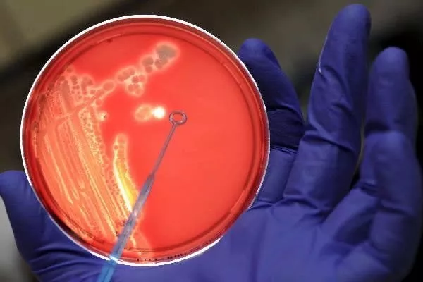 bacteriassuelomariusbecker