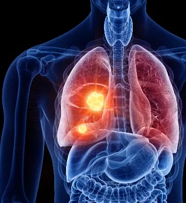Medicina  ha permitido determinar subtipos del mal.
