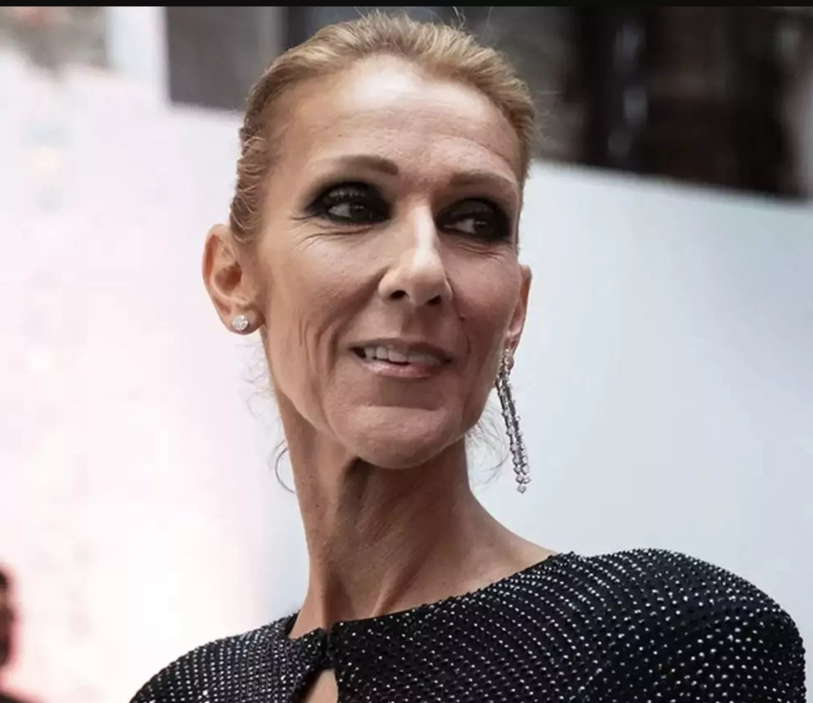 Celine Dion tiene una enfermedad neurológica.