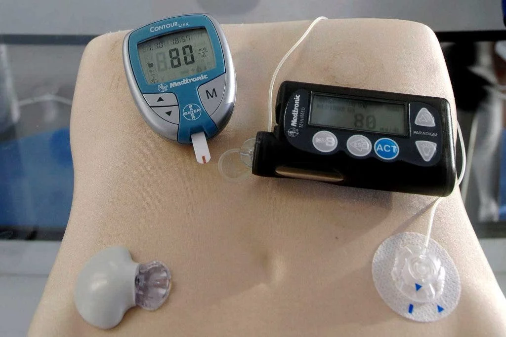 diabetes-bomba-de-insulina-2