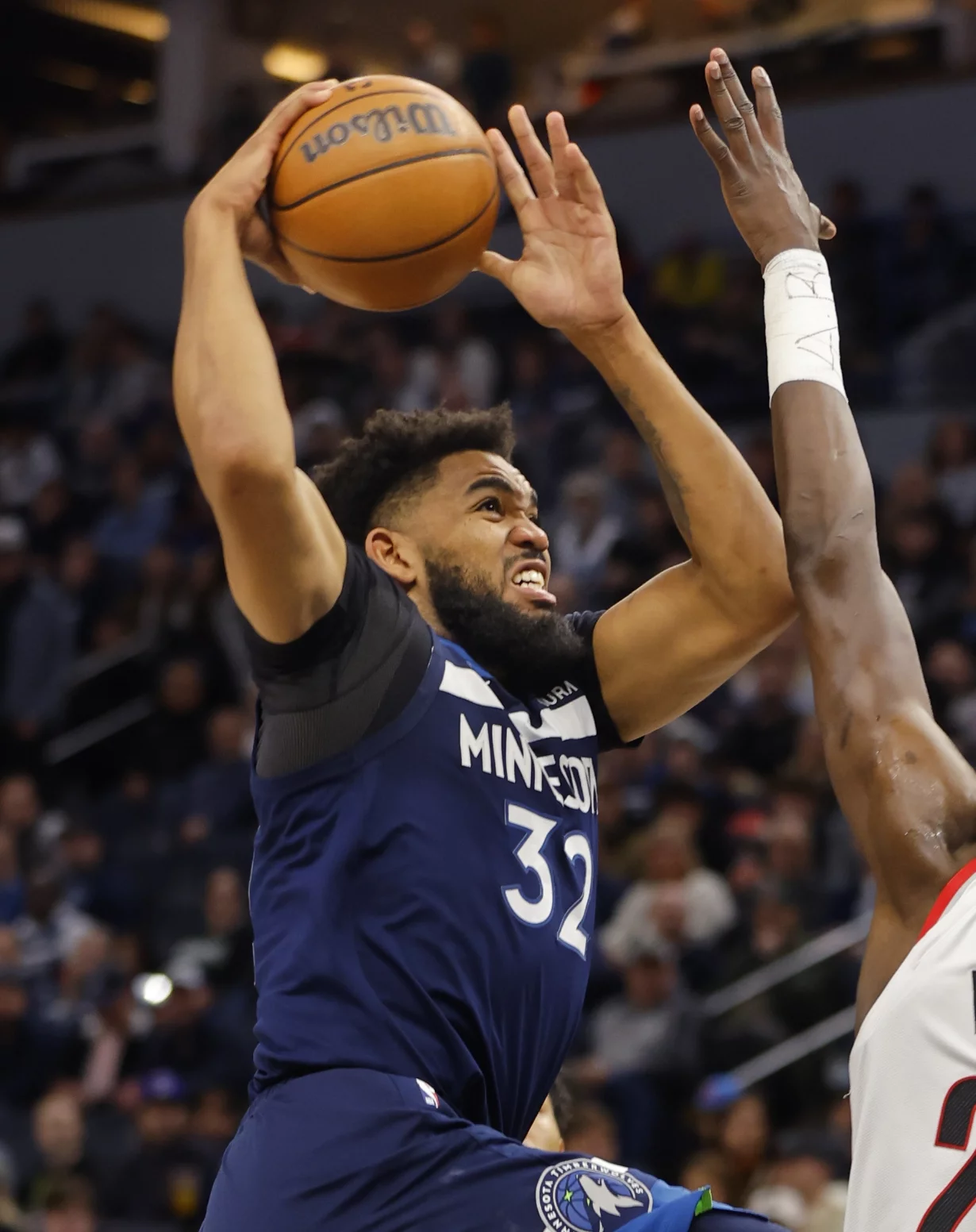 Karl Anthony Towns ha vuelto a sufrir una lesión importante en medio de la temporada.  Ap
