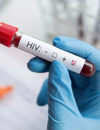 En el país se estima hay 79 mil personas afectadas con VIH.
